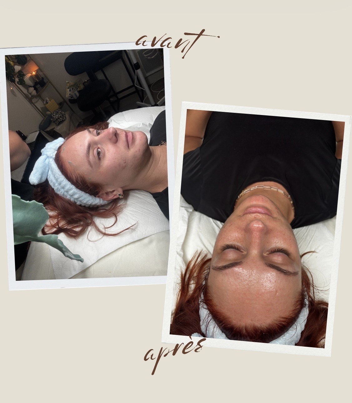 Avant après — soin du visage éclat